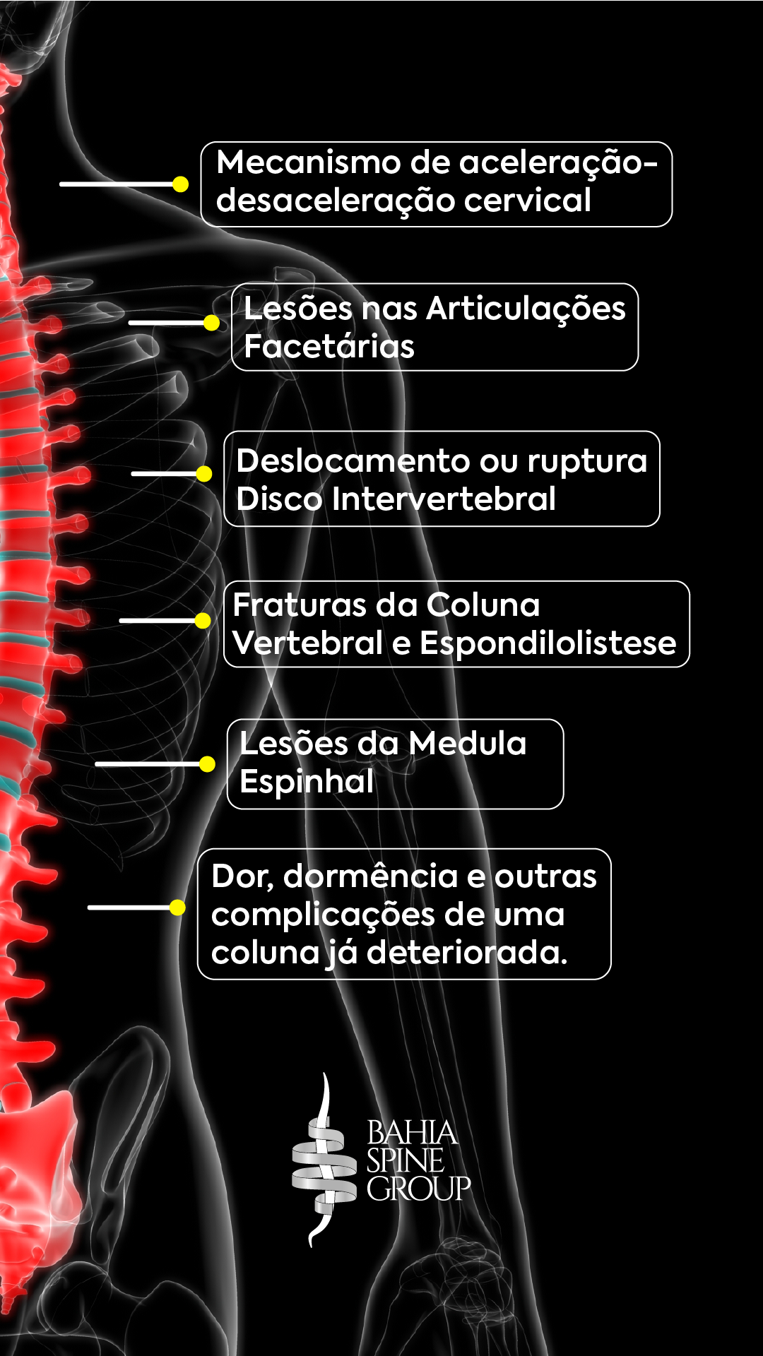 Coluna e acidente de trânsito: quais os danos? - Bahia Spine Group - Grupo  de Coluna da Bahia